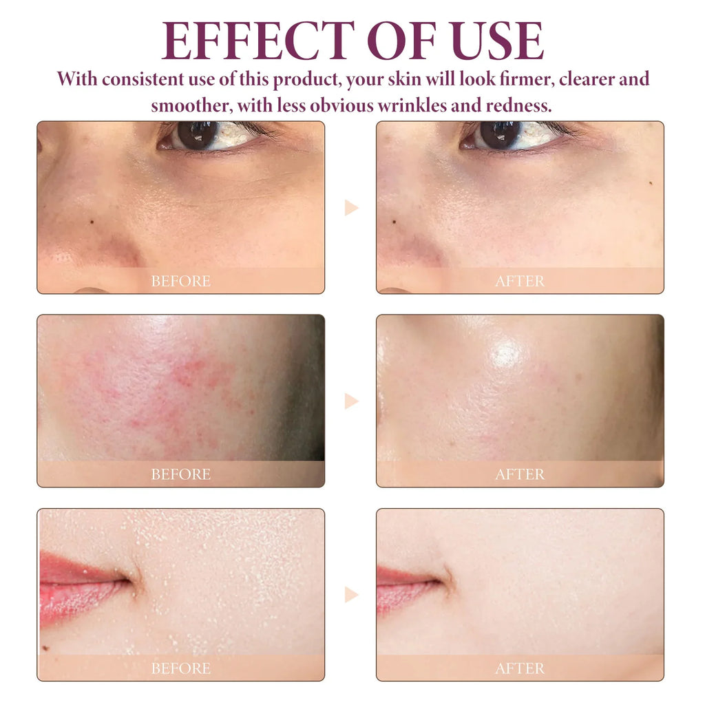 OceAura Glycolic Acid 10% Face Serum – Toning & Firming