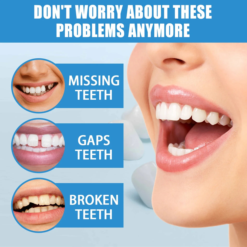 Jaysuing 30g Moldable Temporary Tooth Repair Gel Kit