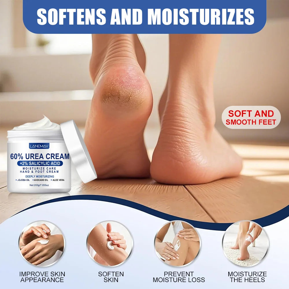 60% Urea Hand & Foot Cream – Salicylic Acid & Glycerin