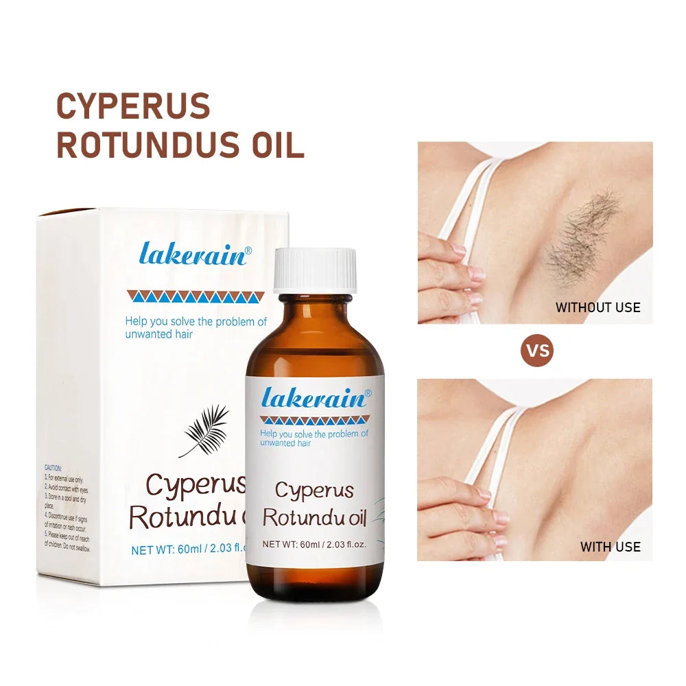 Cyperus Rotundus Hair Growth Inhibitor Oil 60ml | All Skin Types
