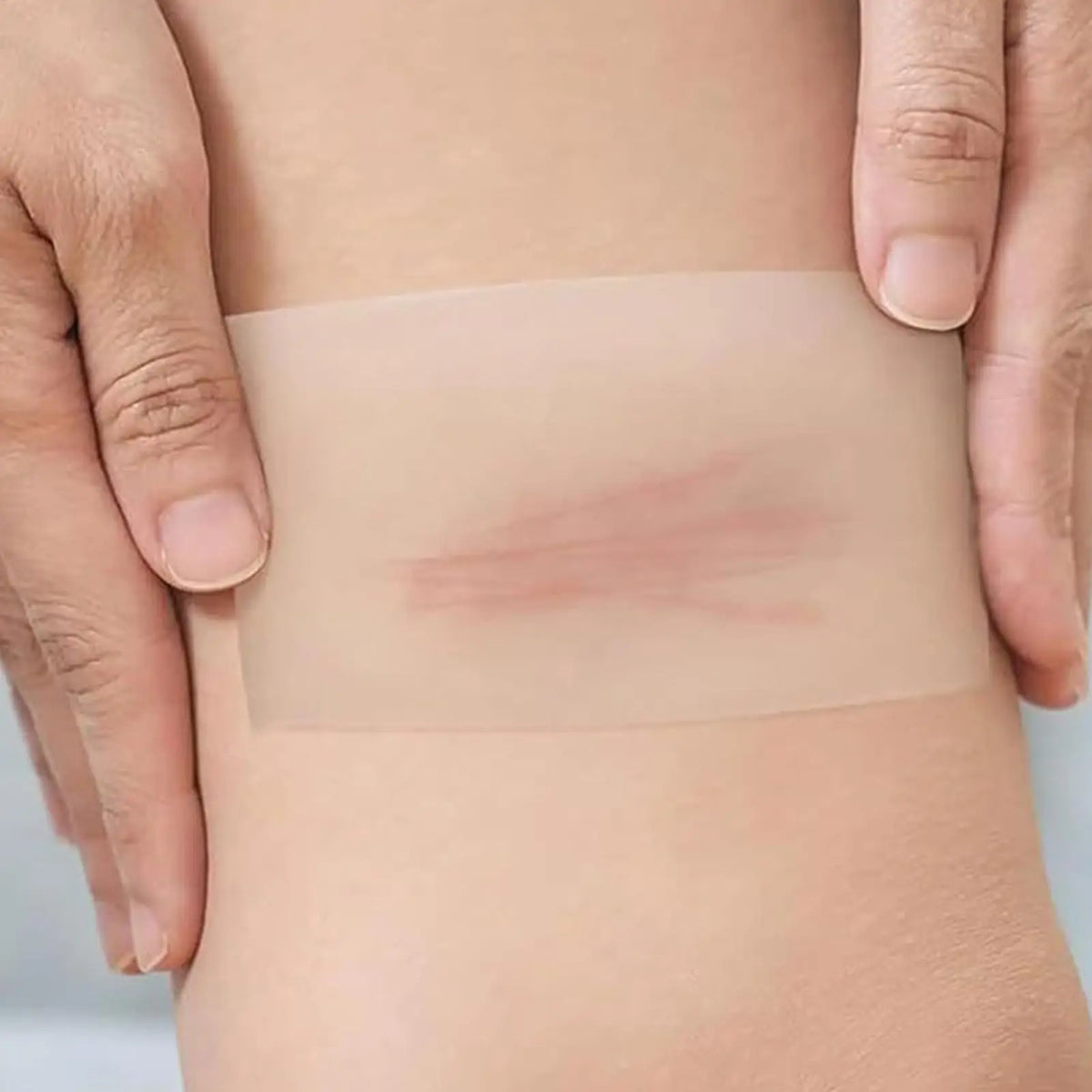 Hydrocolloid Roll Waterproof Pimple Patches Absorbent Flexible Tape