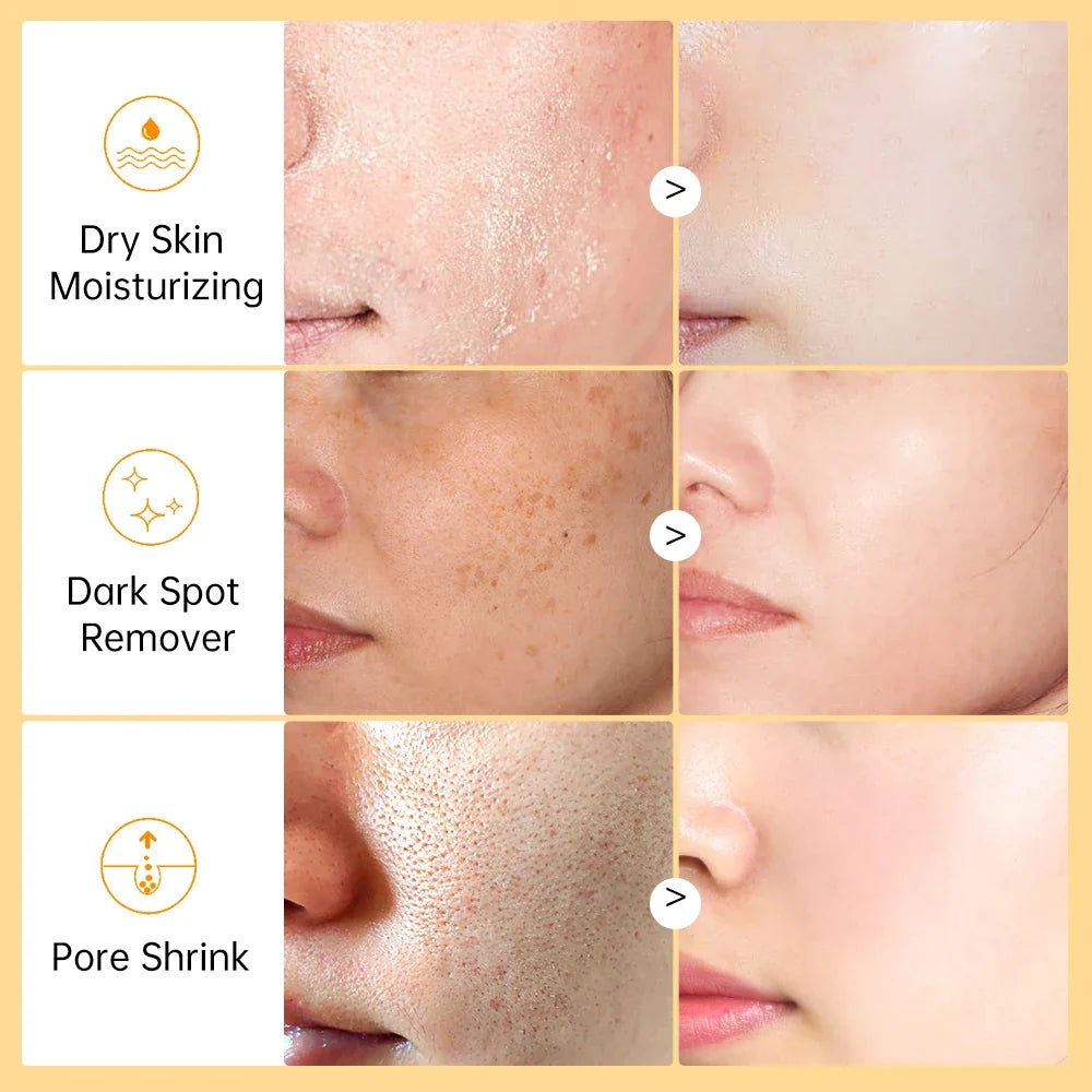 Vitamin C Face Serum – Hyaluronic Acid & Niacinamide 15ml