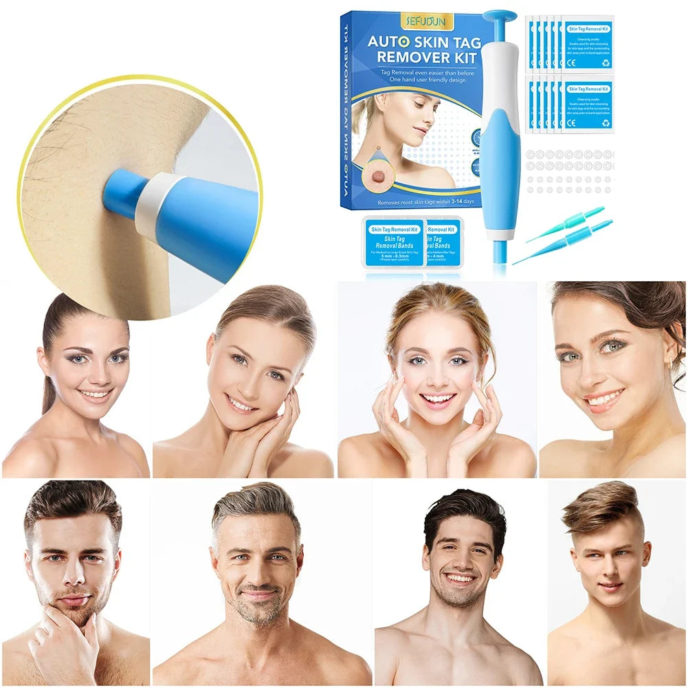 Shunmaii 2-in-1 Skin Tag Remover Kit – Dual-Head Home Tool