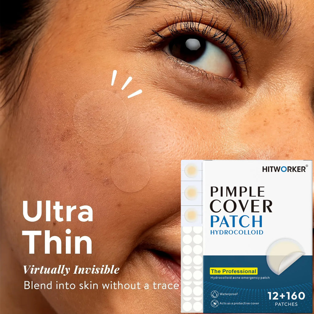 172-Piece Hydrocolloid Acne Patches – Invisible & Waterproof