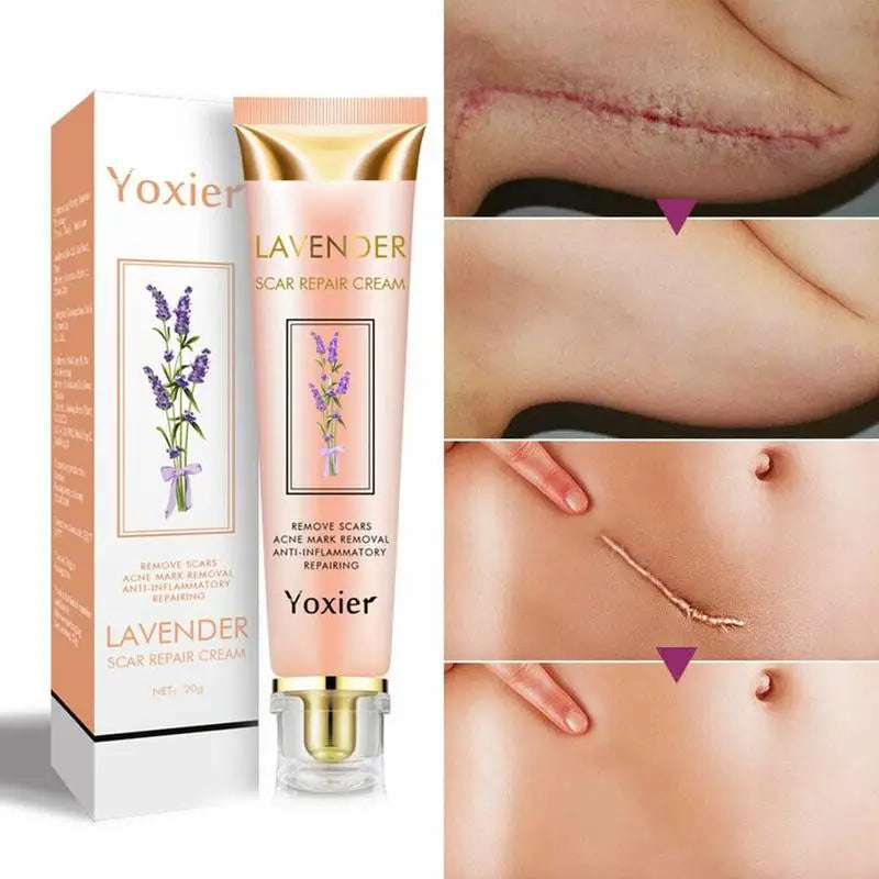 Lavender Scar Repair Cream – Fade Acne Marks & Smooth Skin