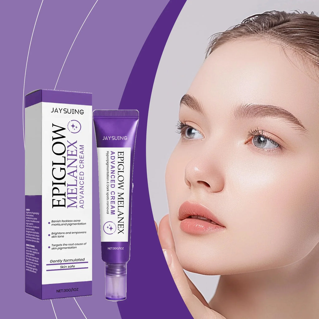 Jaysuing Dark Spot Remover Cream – Melasma & Brightening 30g