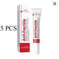 Whitening Freckle Cream – Dark Spot Brightening Face Cream 20g