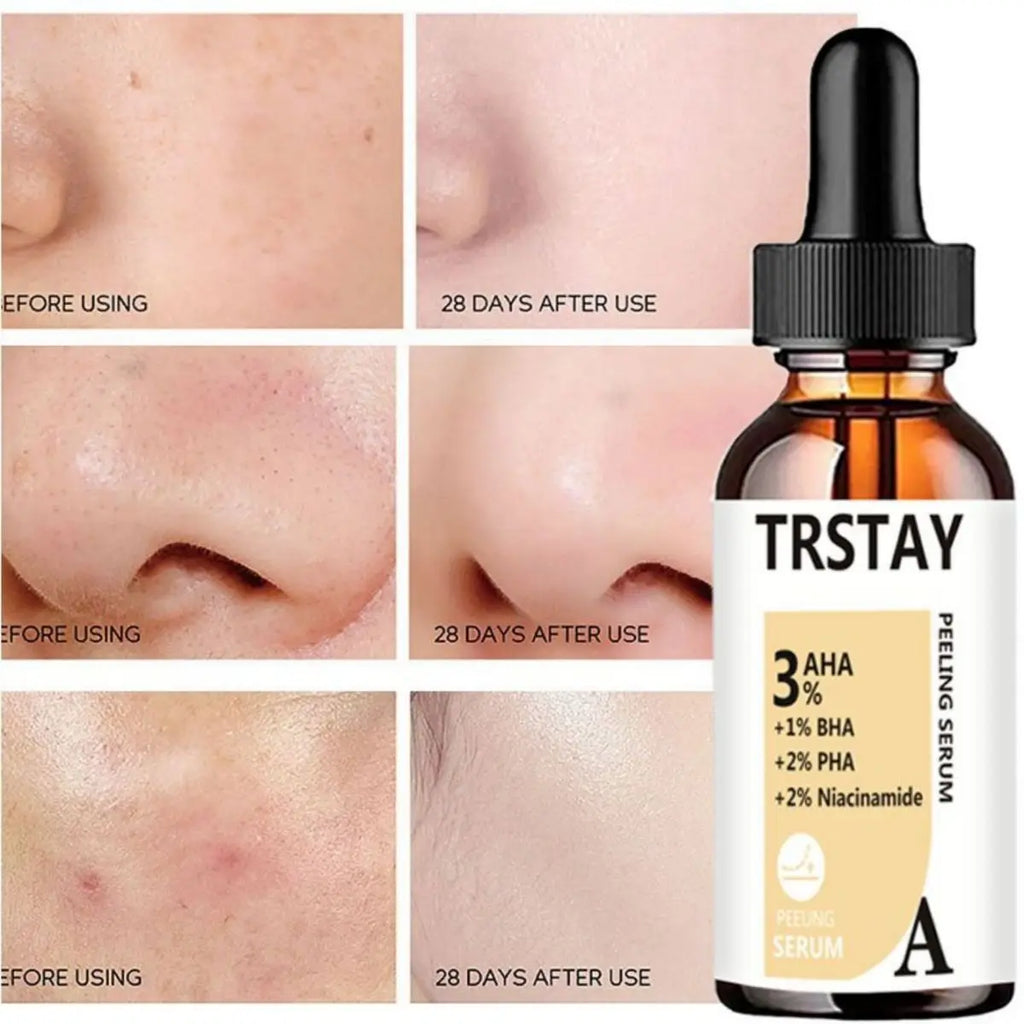 AHA Peeling Serum Salicylic Acid Face Essence Shrink Pores Acne