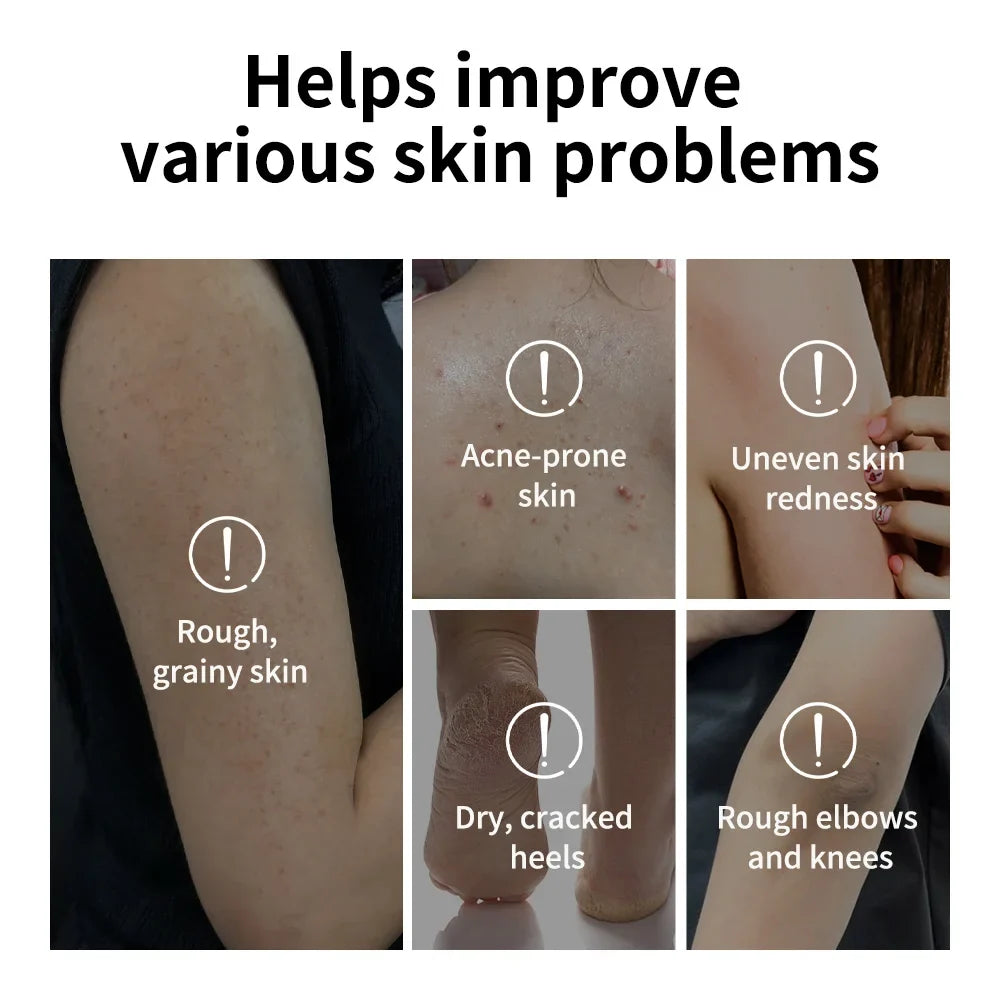 Glycolic Acid Exfoliating Body Stick | Deep Hydration & Smooth Skin
