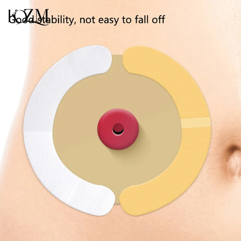 Hydrocolloid Ostomy Barrier Strips 20 Pcs – Waterproof & Elastic