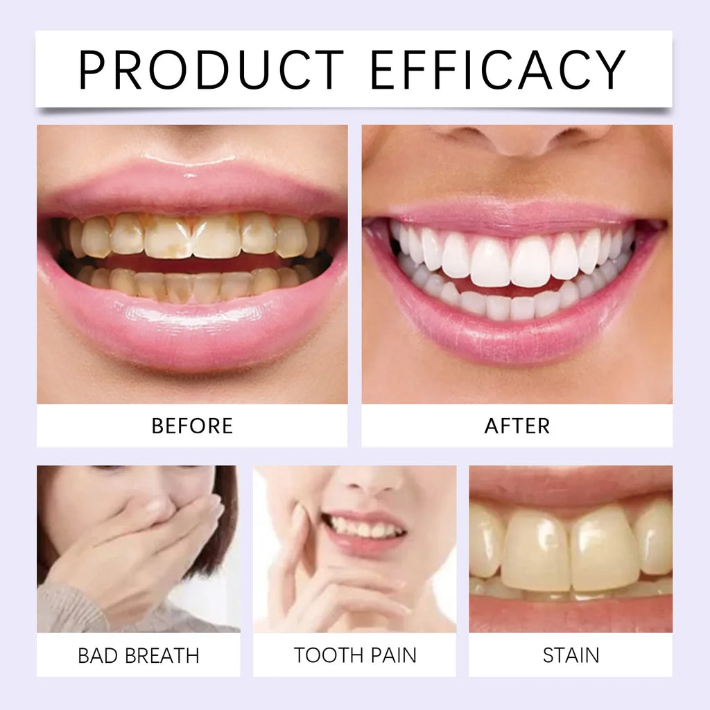 Purple Teeth Brightening Strips – Colour Correcting Oral Care