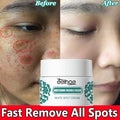 Eelhoe Vitamin C Face Cream – Dark Spot & Brightening Corrector