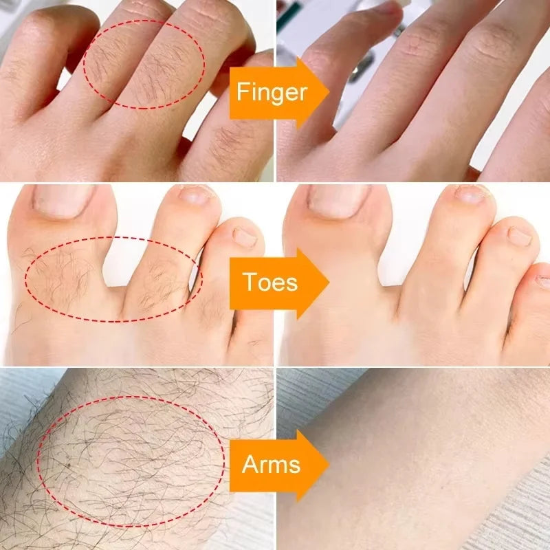 3-Minute Hair Removal Cream – Face, Lip, Arms & Legs