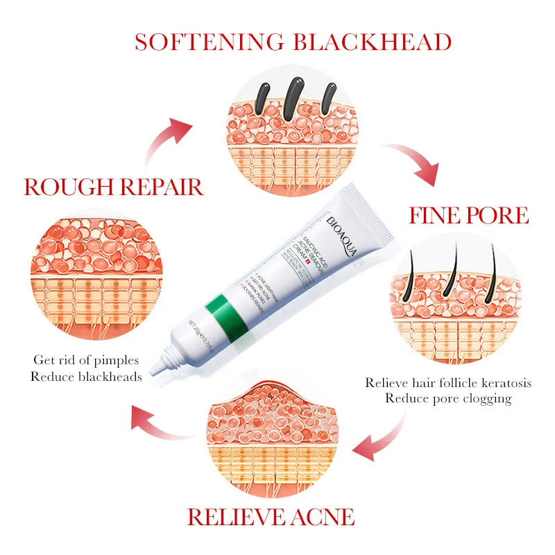 BIOAQUA Salicylic Acid Acne Face Cream – Blackhead & Mark Repair