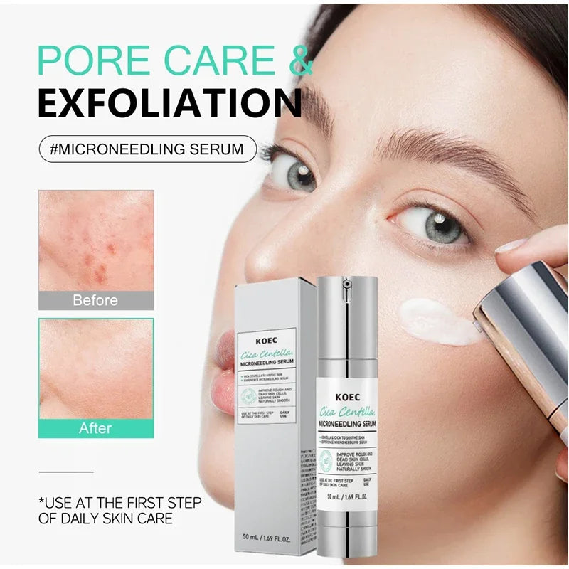 Centella Asiatica Microneedle Serum – Hydrate, Firm & Brighten