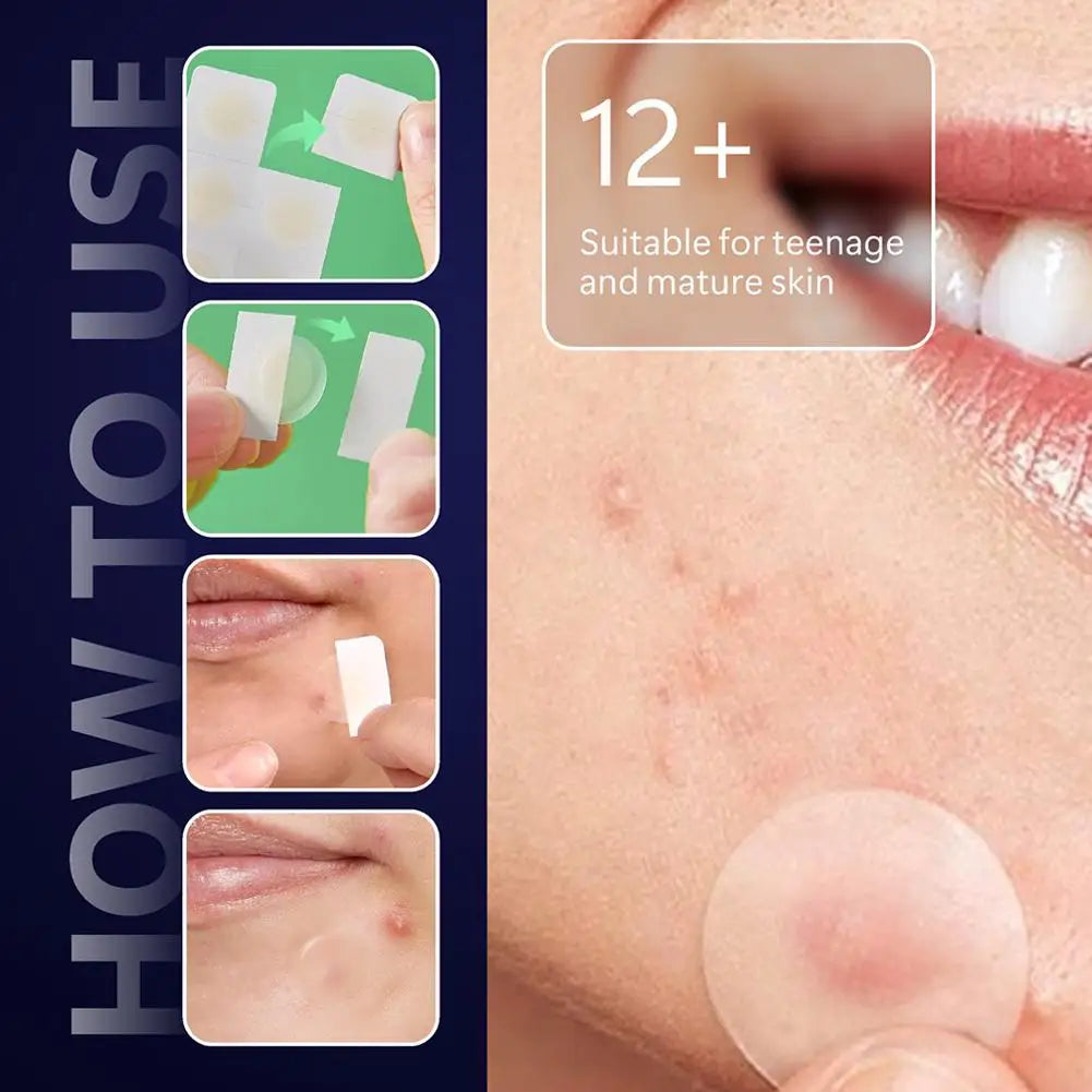 Micro-Dart Pimple Patches – Hydrocolloid Blemish Spot Treatment