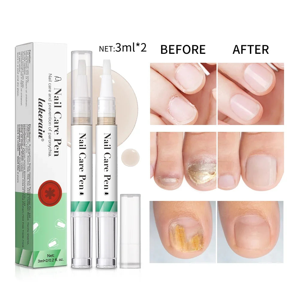 Nail Growth Cuticle Oil Pen – 2-Pack Nail Treatment | ibcccndc