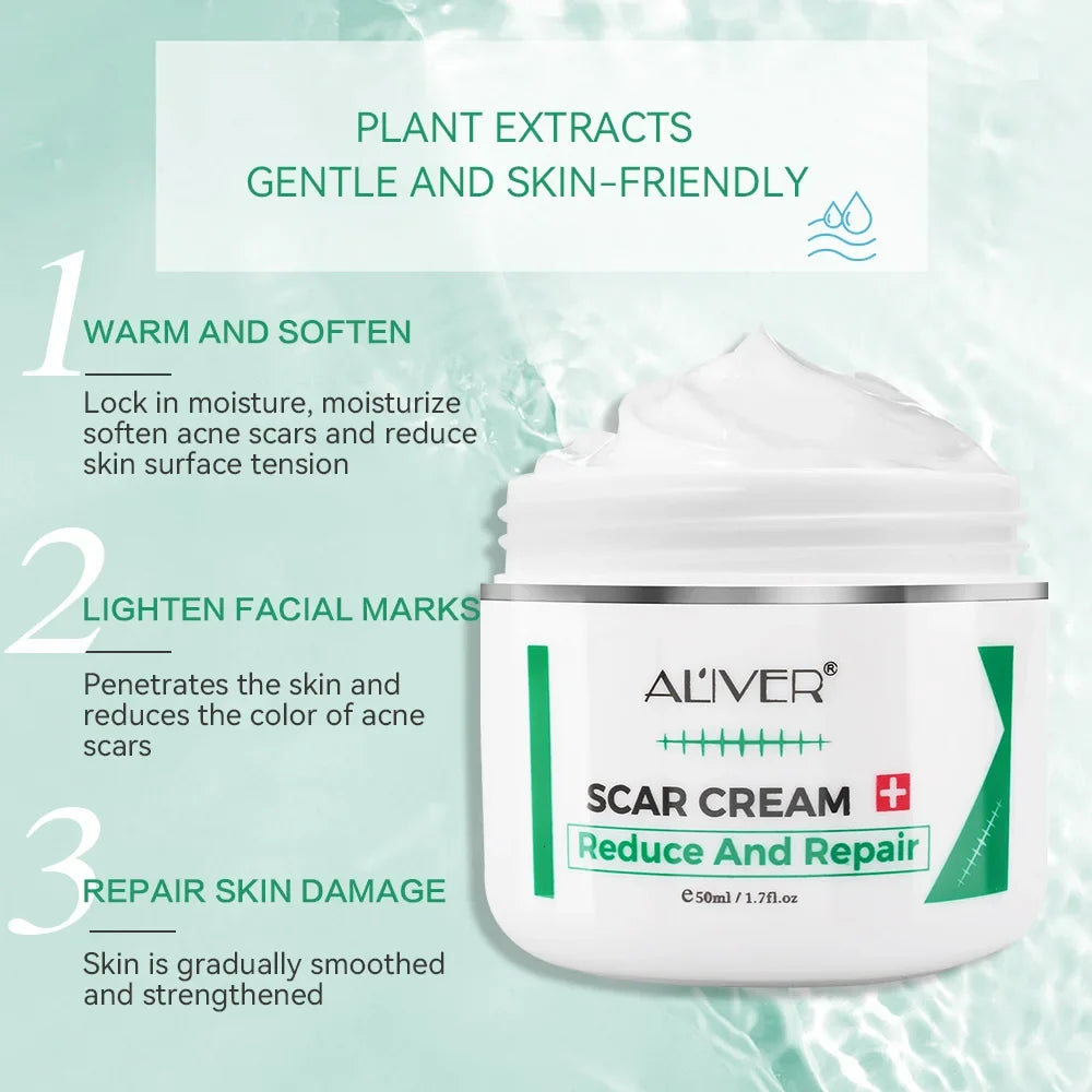 ALVER Acne Scar & Stretch Mark Remover Cream 50ml | Skin Repair