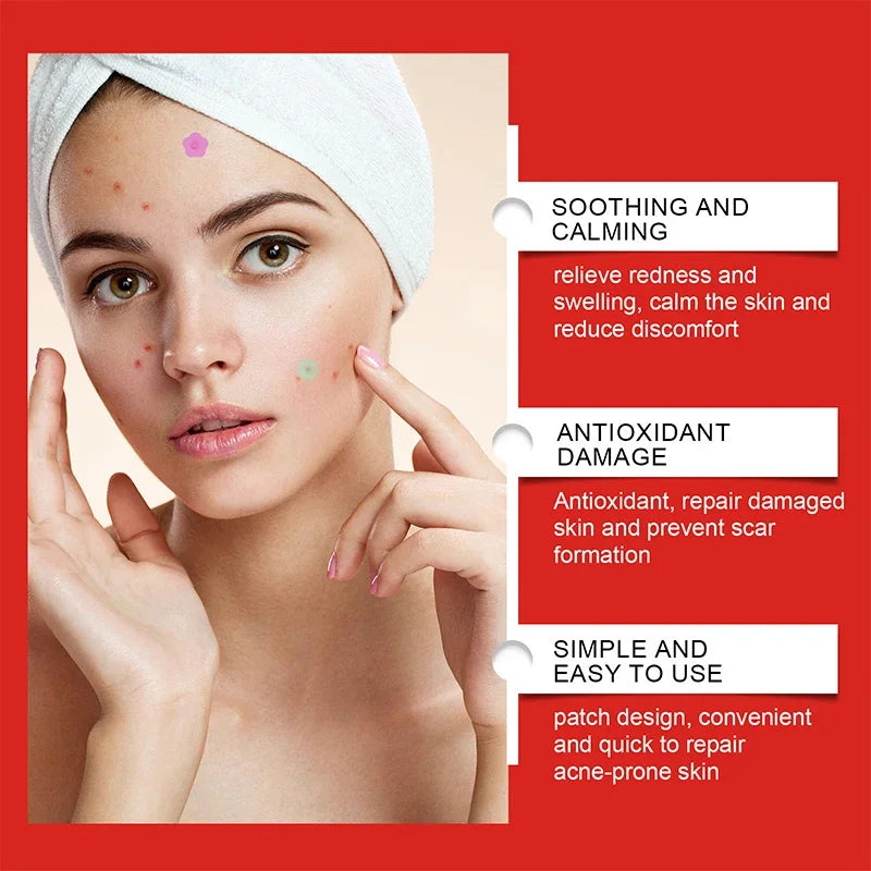 240pcs Salicylic Acid Acne Patches – Star & Heart Pimple Dots