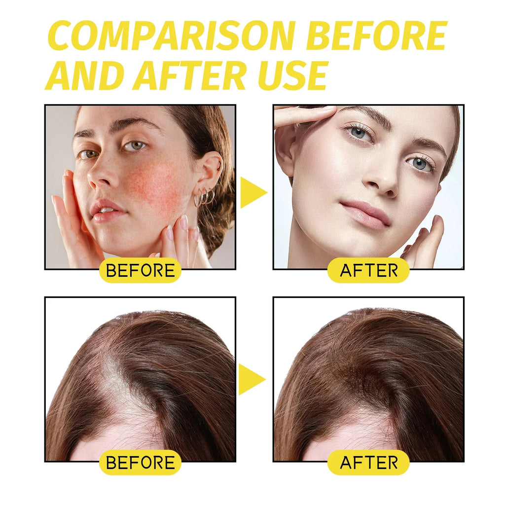 Eelhoe Hair Growth Essential Oil – Scalp & Follicle Treatment