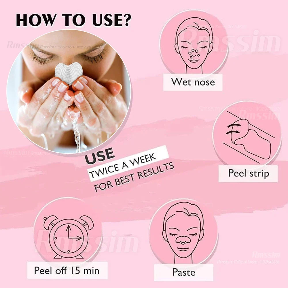 Blackhead Remover Nose Strips – Charcoal & Witch Hazel