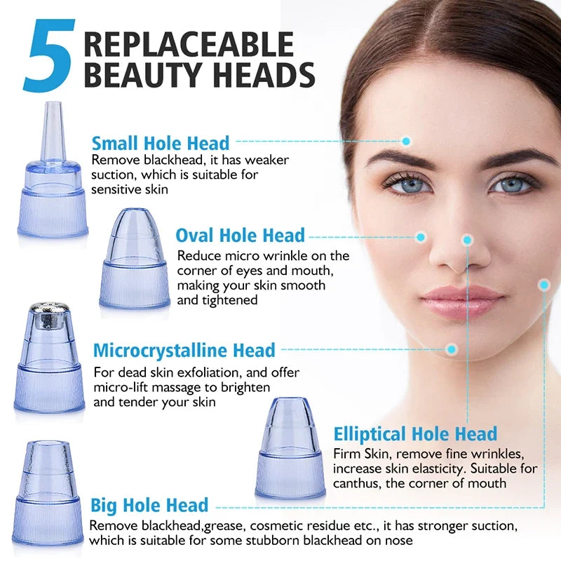 Blackhead Remover Vacuum Pore Cleanser – USB Rechargeable