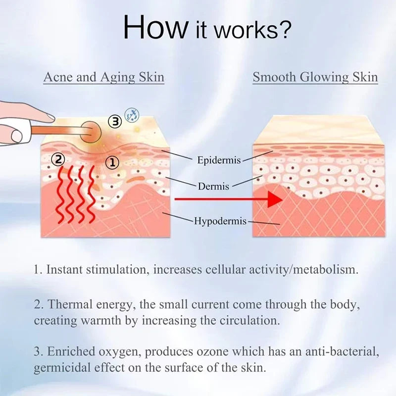 High-Frequency Facial Wand | 4-Electrode Argon Phototherapy Device