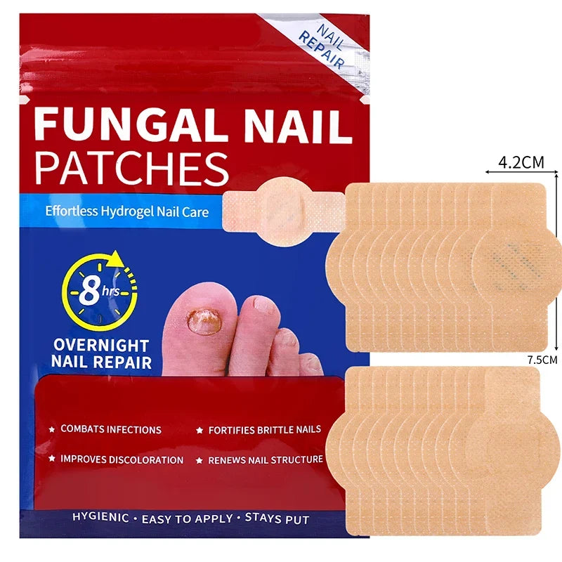 Nail Repair Patches – Toenail Care & Ingrown Correction Stickers