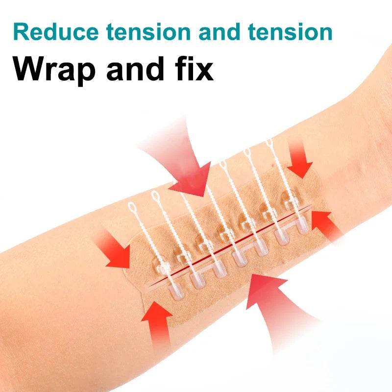 Zipper Wound Closure Patch – Sutureless Hemostatic Bandage