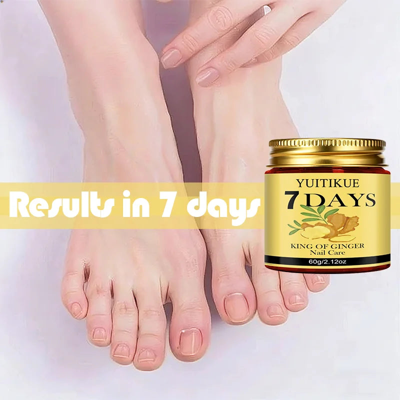 YUITIKUE Ginger King Nail Care Cream – 7-Day Results | 60g