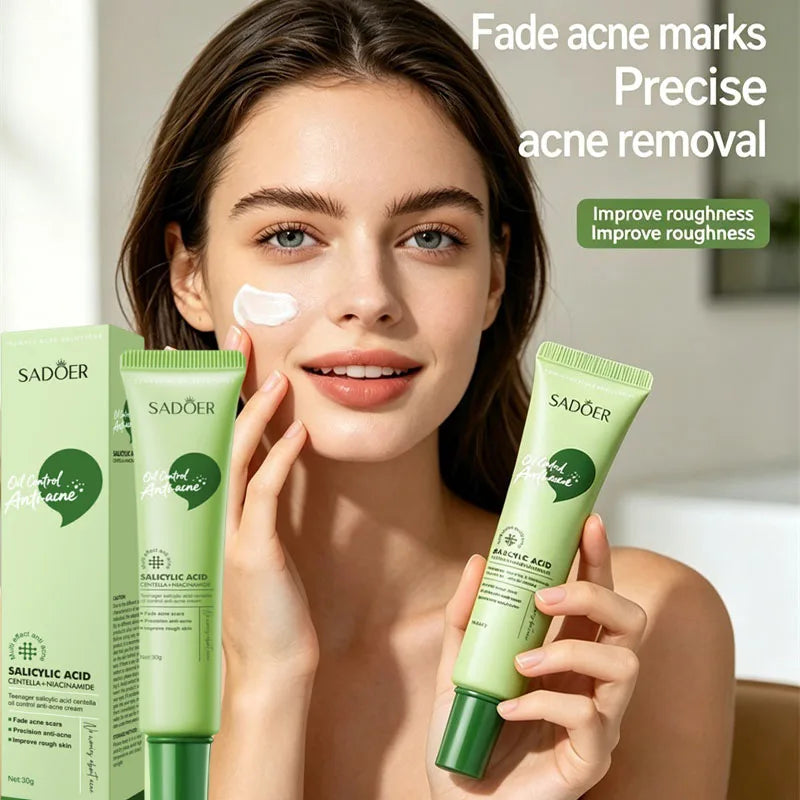 SADOER Salicylic Acid Face Cream – Oil Control & Clear Pores