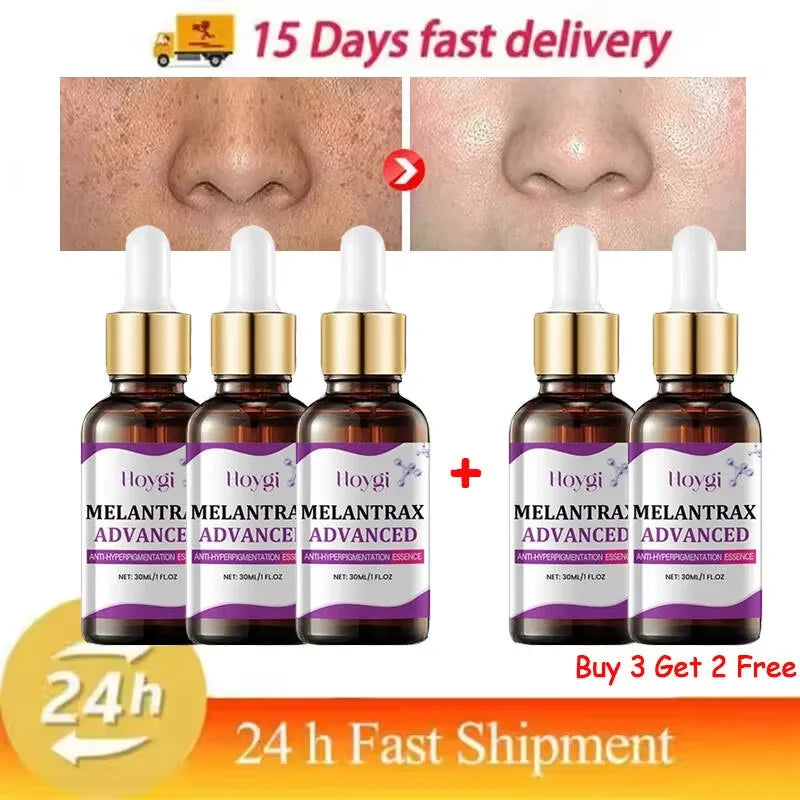 Hoygi Niacinamide Vitamin B3 Face Serum – Glow & Dark Spot Corrector