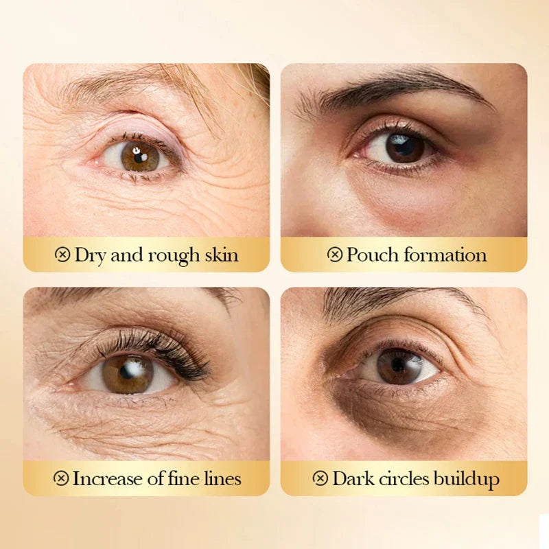SADOER 24K Gold Collagen Eye Mask – Dark Circles & Anti-Aging