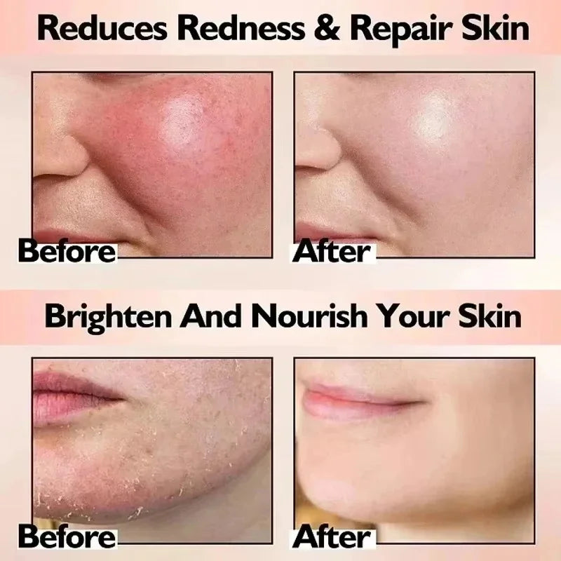 SADOER Soothing Face Cream – Sensitive Skin Moisturizer