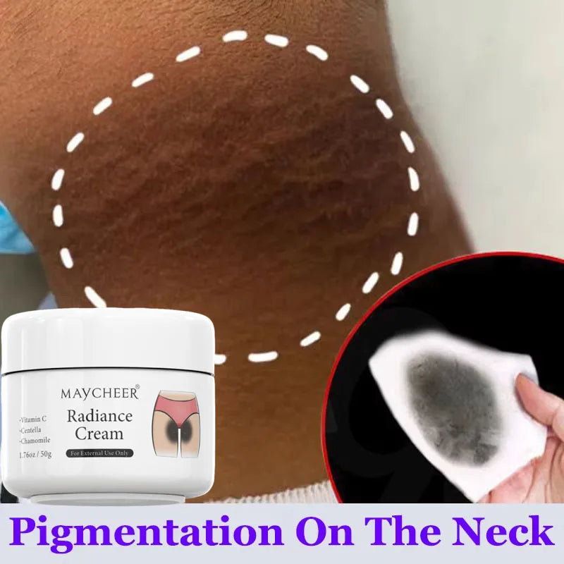 Brightening Cream Underarms Knees & Intimate Areas | 50g