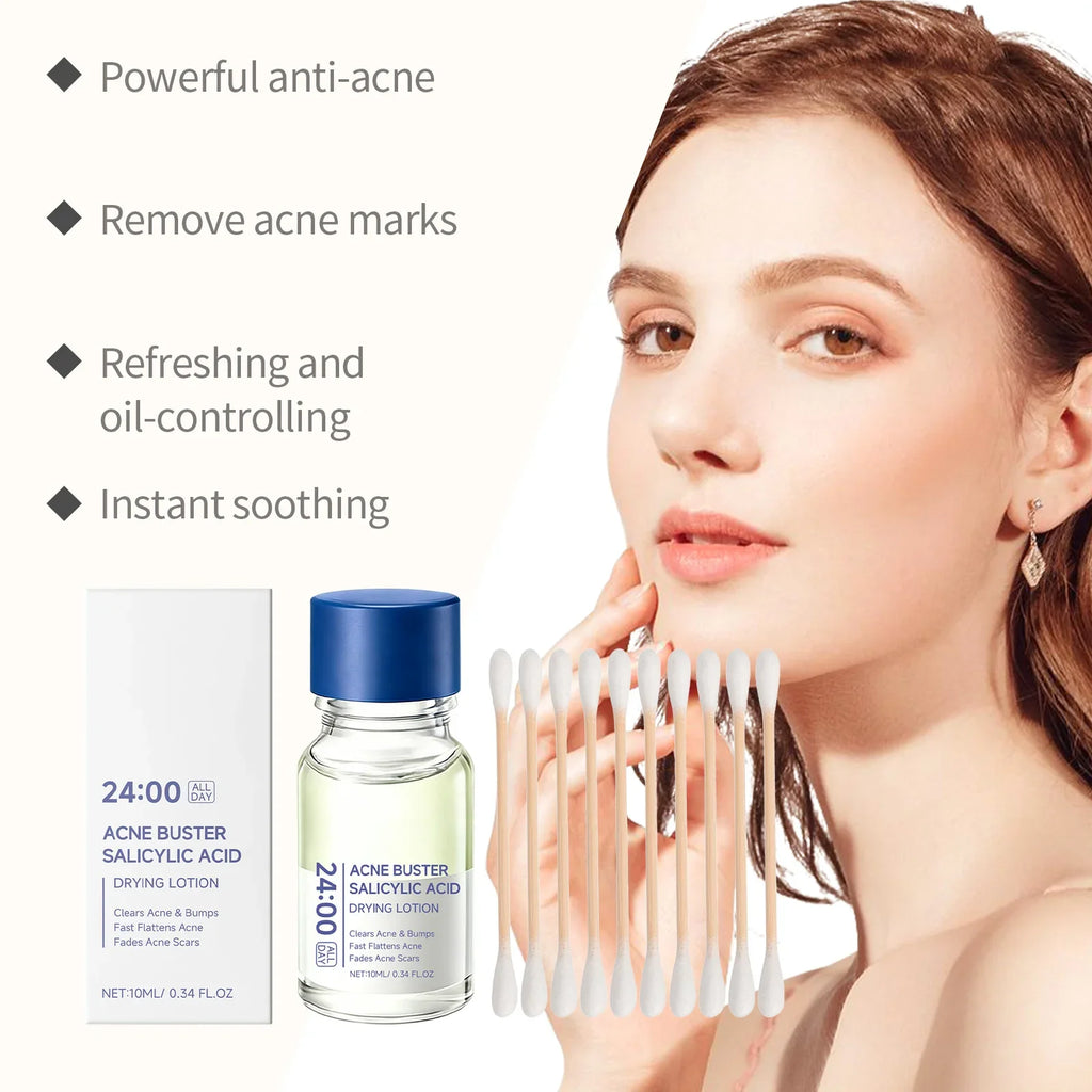 Hoygi Salicylic Acid Acne Serum – Pores, Blackheads & Oil
