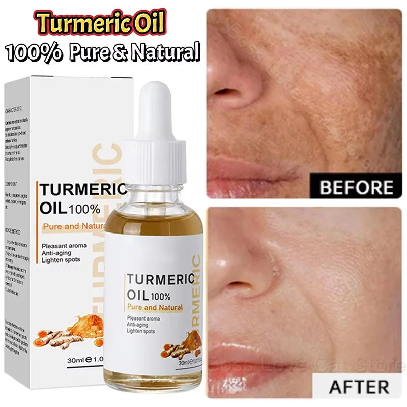 Turmeric Oil Dark Spot Brightening Facial Serum | eelhoe