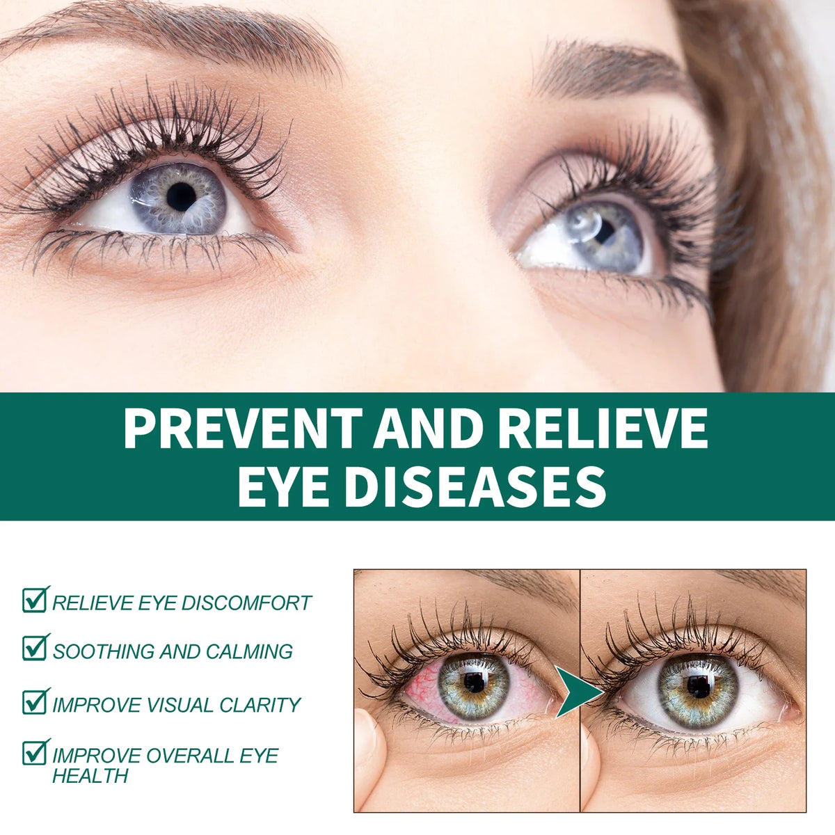 Eye Massage Roller – Acupressure Eye Care & Moisturizing Serum
