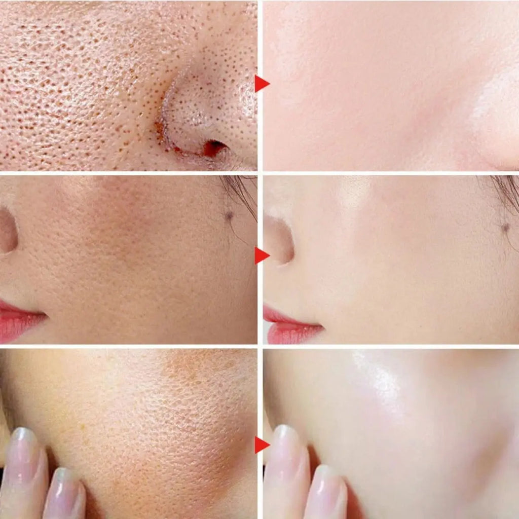 Pore Minimizer Serum Face Facial Narrowing Contraction Tightens