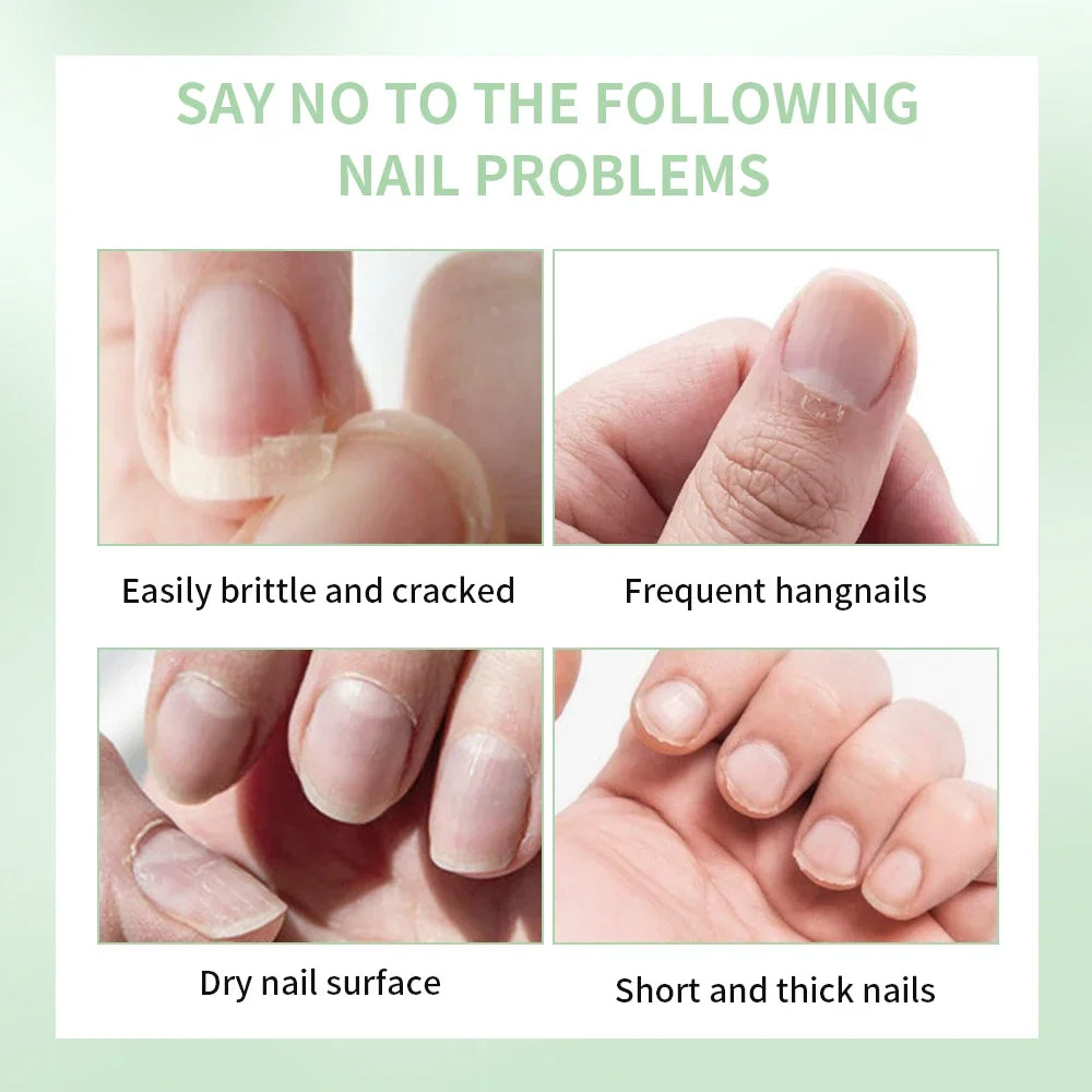Nail Growth Strengthening Oil – Cuticle Treatment 5ml