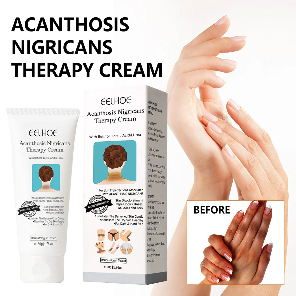 Eelhoe Dark Spot Brightening Body Cream 50g | Even Skin Tone