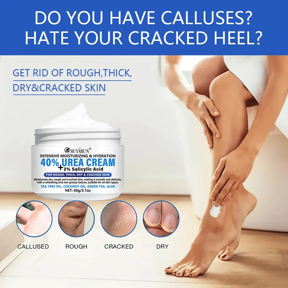 SUYARUN 40% Urea Foot Cream Stick – Hydrate & Exfoliate Heels