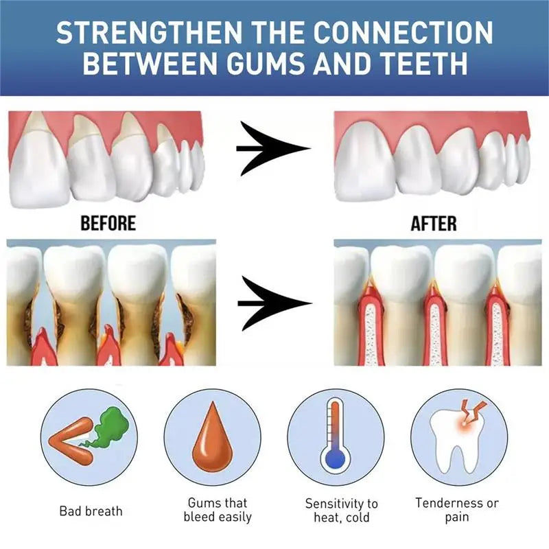 Eelhoe Gum Care Repair Gel – Whitening & Fresh Breath