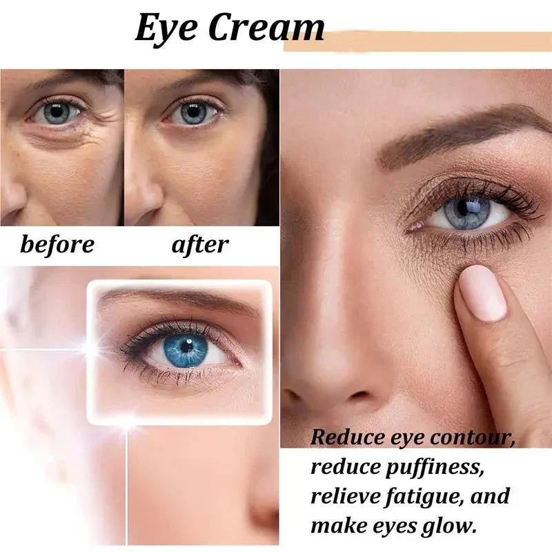 Retinol Eye Cream – Firming, Dark Circle & Hydrating 15ml