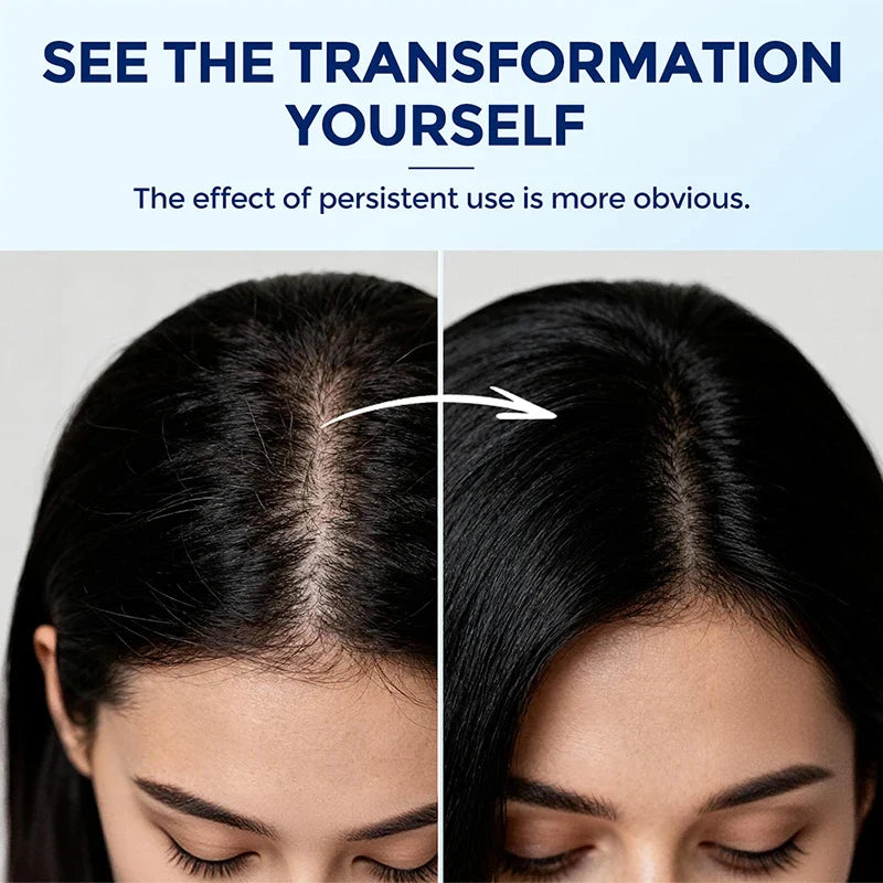 LEWEDO Rosemary Roll-On Hair Serum – Anti-Frizz & Oil Control