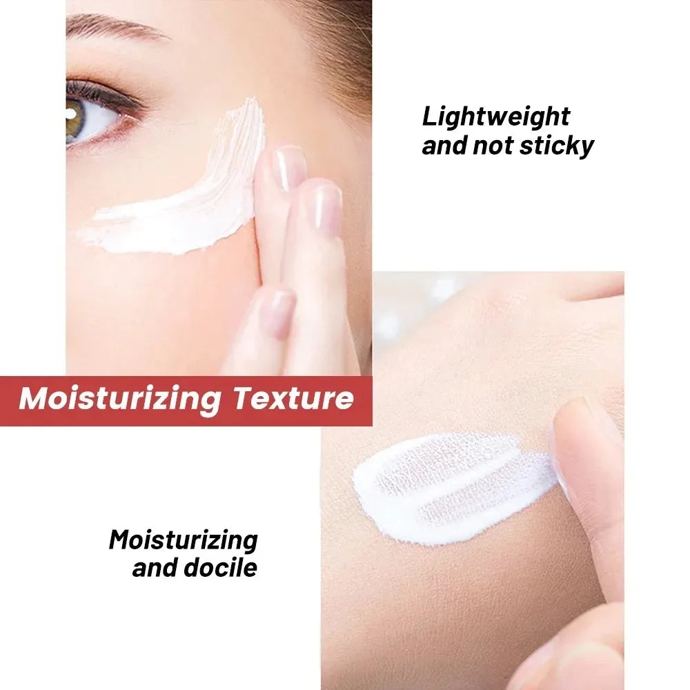 Niacinamide Whitening Freckle Cream | Dark Spot & Melasma