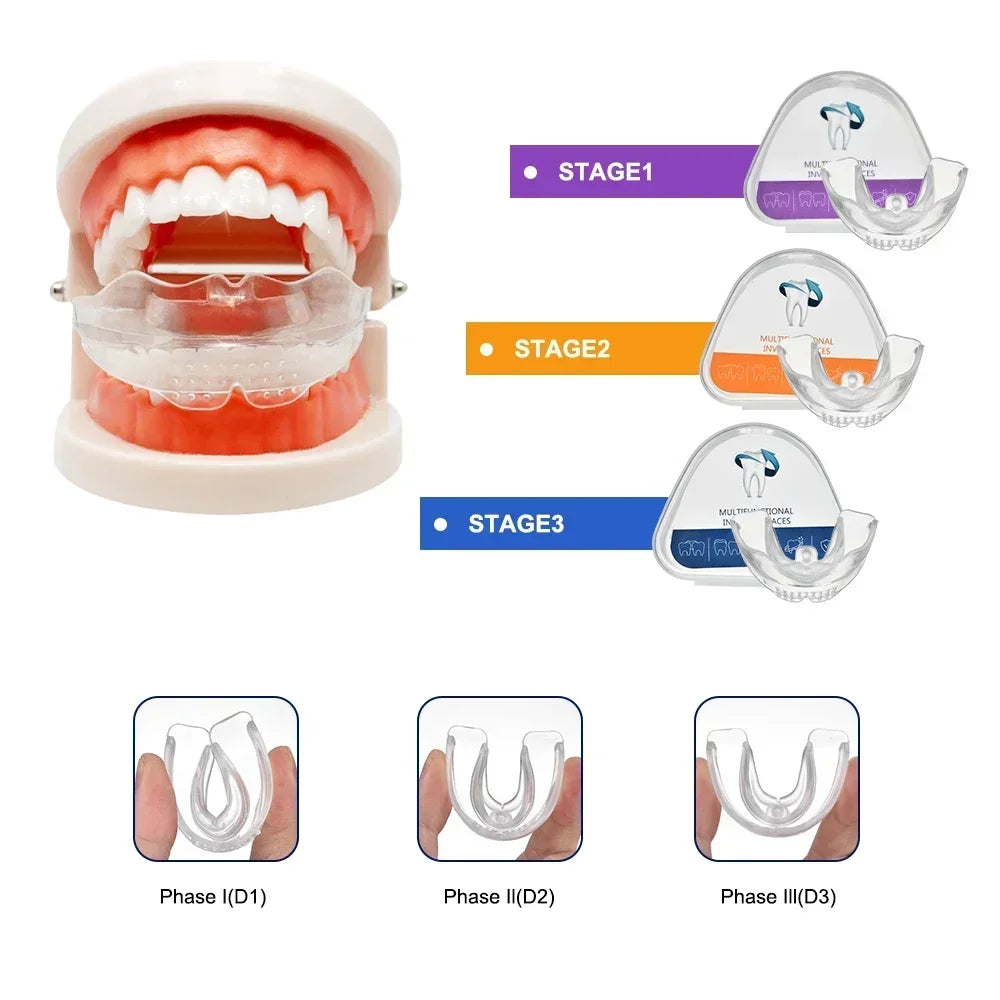 3-Stage Transparent Teeth Aligners | Adult Dental Straightening Kit