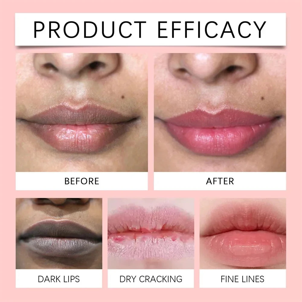Lip Brightening Overnight Balm – Exfoliate, Moisturize 8.5g