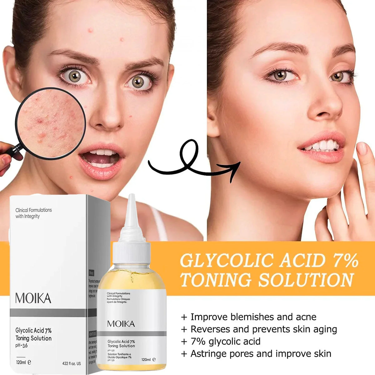 Glycolic Acid 7% Exfoliating Toner | Pore Minimizing & Oil Control