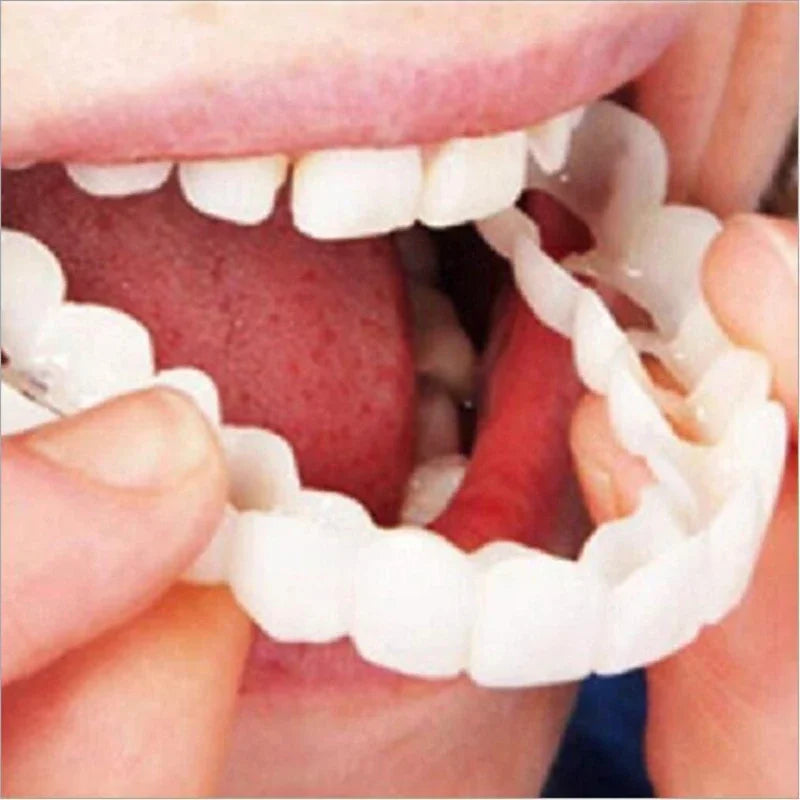 Snap-On Teeth Veneers | Temporary Cosmetic Smile Cover Set